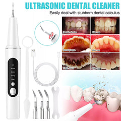 Ultrasonic Tooth Cleaner with LED Light & UV Sterilization – Deep Dental Care Device